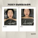 3846 | [서울/강남역 경락] 서초동 에스테틱 가인미가 강남본점 신논현역 서울 얼굴 경락 후기