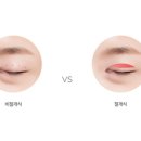 강남뷰티업성형외과의원 이미지