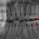 고운e치과 이미지