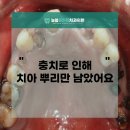 늘봄플란트치과 이미지