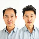 정상로 | (삼척)가발전문 최살롱!남자정수리가발!여자부분가발.앞머리가발