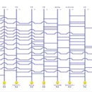 예손헤어라인 이미지