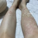 (주)하우투약 | [임신 30주~31주] 임신소양증 극복 / 퓨어락맘스밀 / 일상