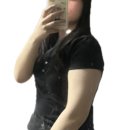 365엠씨(mc)병원 | 👙 [무한람스 리얼 후기] 허벅지 팔뚝 무한람스 — 5주차 찐 후기👙