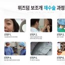 보조개1 이미지