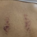 모아여인숙 | 다낭 마사시샵 소동