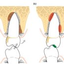필치과기공소 | 강원치과, 동내 치과를 대학병원에서 추천한 이유? [임플란트]