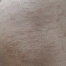 스킨52부천지부 이미지