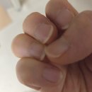 D.K 네일 | 맥주효모 비오틴 10000, 탈모 새치 고민 끝? 제가 겪은 머릿결 변화 솔직후기