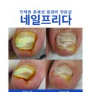 네일프리다 이미지