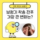 덕진-76 | 덕진구 보청기 착용 전후 비교, 실제 착용자가 느낀 가장 큰 변화