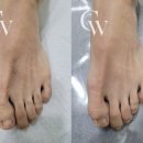 캐치업왁싱김포점 네이버블로그