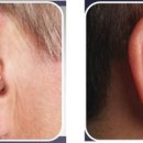 분당연세보청기 이미지