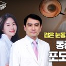 헬스조선 건강똑똑 '포도막염' 편 영상 후기 댓글 이벤트 ~1.2 이미지