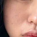 휴힐 | 환절기 예민해진 피부, 휴힐 센텔라 시카 진정 장벽 세럼으로 3중 케어 시작하세요