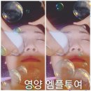 쁘리띠테라피 | 청라피부샵 쁘리띠테라피 펩타이드&콜라겐 2차 관리 후기!