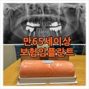 블루덴치과의원 네이버블로그