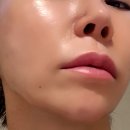 압구정찜질방사우나 | 압구정 피부과 티타늄리프팅 효과 후기