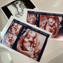 신광준혹달린신발김포센터 | 출산선물/ 호랑이띠 선물/ 아기덧신/ 도시락 케이크/ 임산부 신발 추천 혹달린신발/ 닥터앤닥터 육아일기