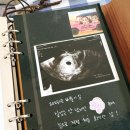 문산부인과 | ✨포유문산부인과 초음파앨범 꾸미기 행사 참석 후기🥰