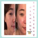 하단 여드름 피부관리샵 시크릿에스테틱 원데이필 받은 후기