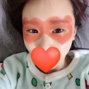 메디어스 | 주름패치 메디어스 하트뿅뿅 아이패치 사용후기