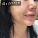 큐어
