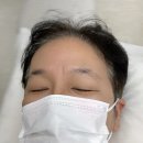 노이즈빨대