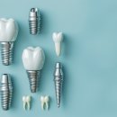 열린오치과의원 이미지