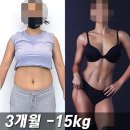 증산-005 | 건강 관리를 위한 최고의 선택