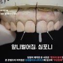 심포니치과기공소 이미지