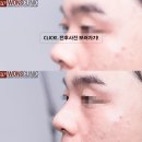 하이코코 이미지