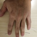 20235514 백재준 의안과제(2) 이미지