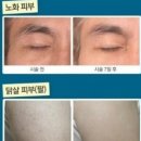뉴미인