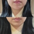 씨유성남메드위즈점 | 성남 신흥동 피부관리 하이푸 리프팅 후기 [더예쁨]