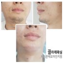 끌라레왁싱