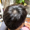 명장2 치안센터 | [창원] 40대 남성 정수리 고민 해결창원명장두피탈모관리센터 빈모축소 리얼 후기