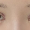 아이그램성형외과 이미지