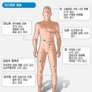산중에 쥐가 낫을때 응급 처치 방법과 아스피린의 효과 이미지