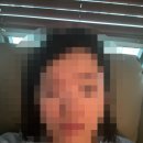 [광고X] 강남 GS안과 스마일라식 혼자 받고옴, 2주차 후기(w.김무연 원장님)