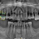분평주공2단지경로당 이미지
