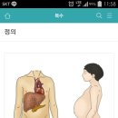 복수 3 이미지