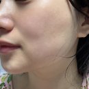 에이치바이옴 이미지