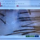 두피힐링 대구두피관리 헤드스파K 상인점