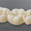 엔도코어 이미지