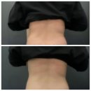 창원복부관리 받고 온 후기, 창원 가음동 에스테틱담