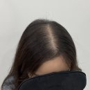 림스칼프 이미지