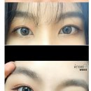 아이그램성형외과 이미지