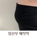 진해구 ⓒ-32 | 임산부 배딱딱 배단단 이유는 무엇일까