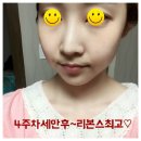 !@리본스화장품 성공후기~팔자주름 모공축소 미백 리프팅 성형화장품 대박~@